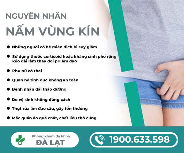 Hình ảnh minh họa